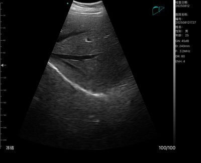 C10TX-PRO Dual Head Convex & Linear Hand-Held Ultrasound