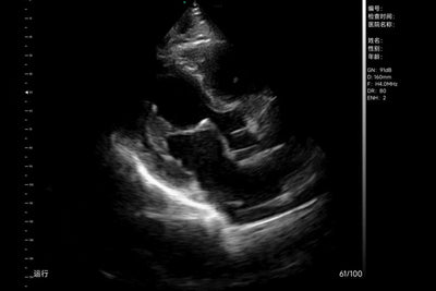 C10TX-PRO Dual Head Convex & Linear Hand-Held Ultrasound