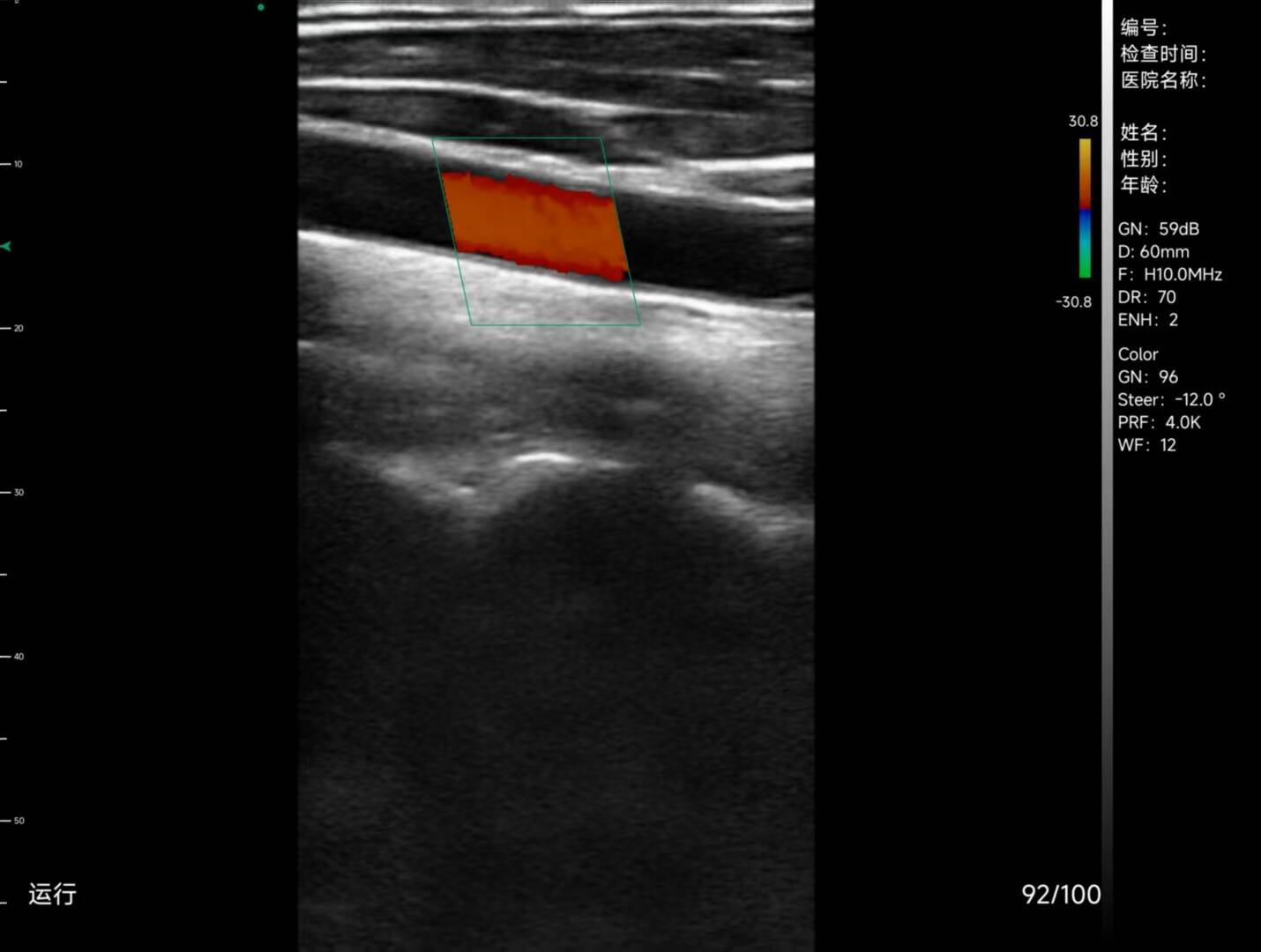 C10TX-PRO Dual Head Convex & Linear Hand-Held Ultrasound