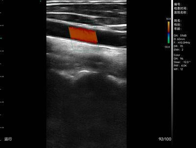 C10TX-PRO Dual Head Convex & Linear Hand-Held Ultrasound
