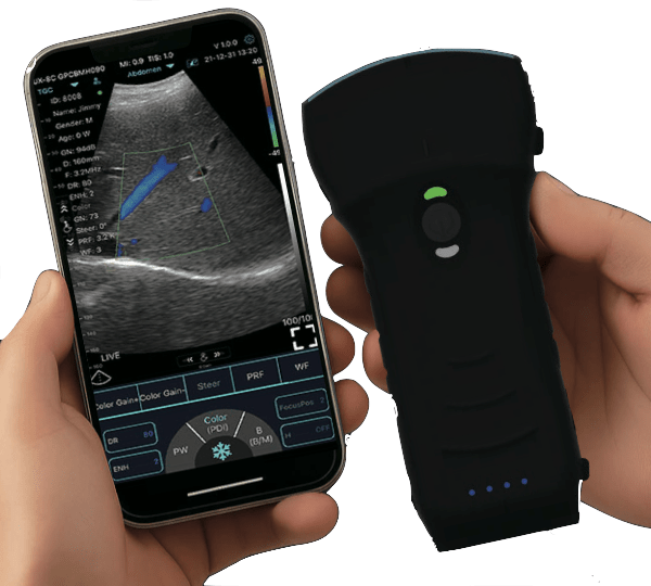 C10TX-PRO Dual Head Convex & Linear Hand-Held Ultrasound