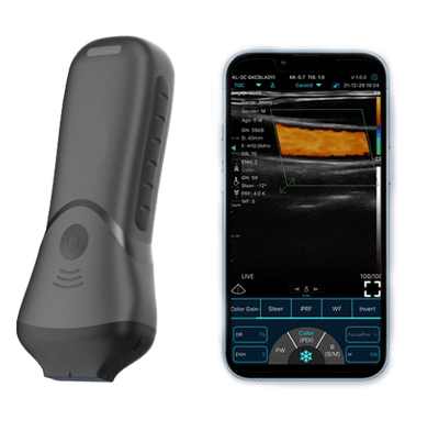 C10MS Pro B&W/Colour 14Mhz Superficial Hand-Held Ultrasound - InterAktiv Health