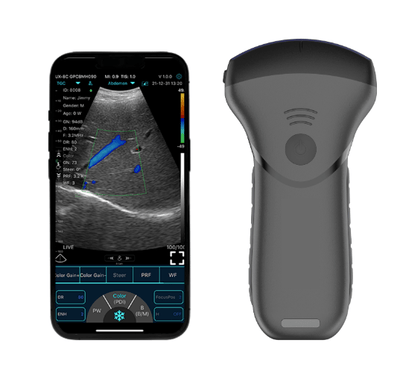 C10MT-Pro USB&Wifi Convex Abdominal Hand-Held Ultrasound - InterAktiv Health