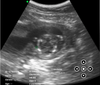 C10RN B&W Abdomen Convex Hand-Held Ultrasound - InterAktiv Health