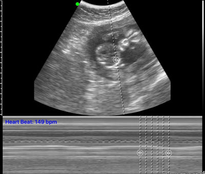 C10RN B&W Abdomen Convex Hand-Held Ultrasound - InterAktiv Health