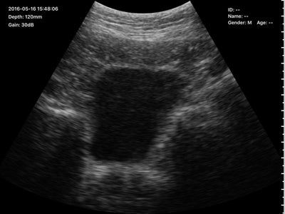 C10RN B&W Abdomen Convex Hand-Held Ultrasound - InterAktiv Health