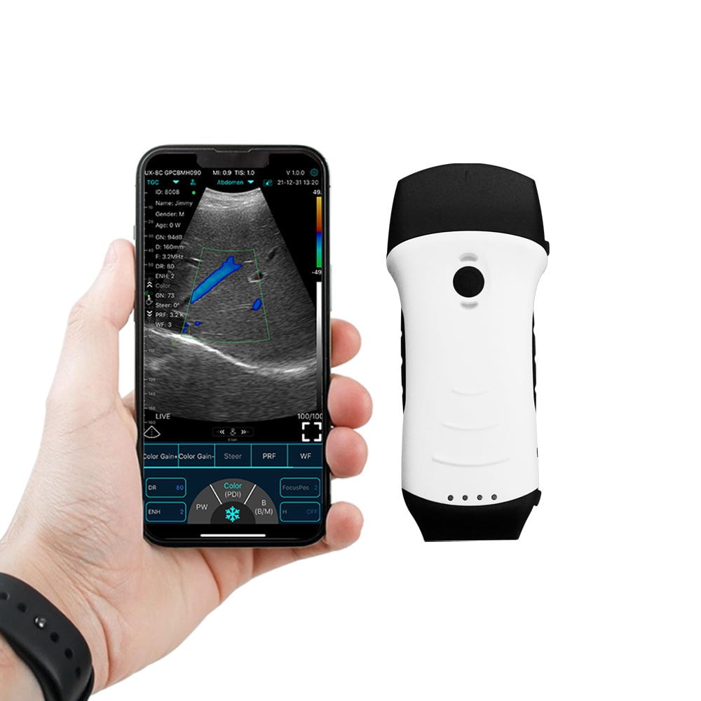 Ultrasound Machines