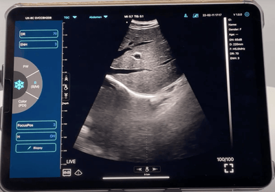 C10TX Dual Head Convex & Linear Wireless Hand-Held Ultrasound - InterAktiv Health