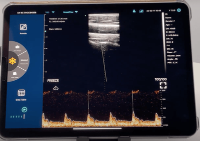 C10TX Dual Head Convex & Linear Wireless Hand-Held Ultrasound - InterAktiv Health