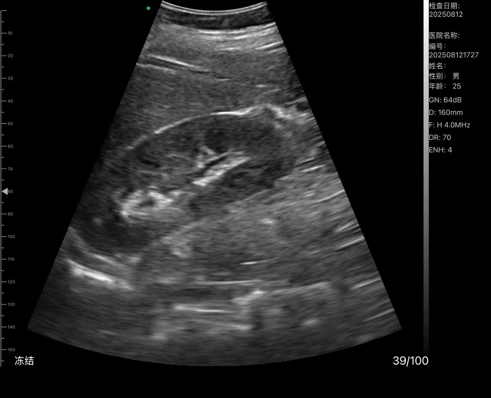 C10TX-PRO Dual Head Convex & Linear Hand-Held Ultrasound