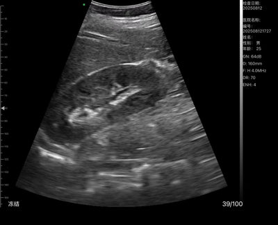 C10TX-PRO Dual Head Convex & Linear Hand-Held Ultrasound