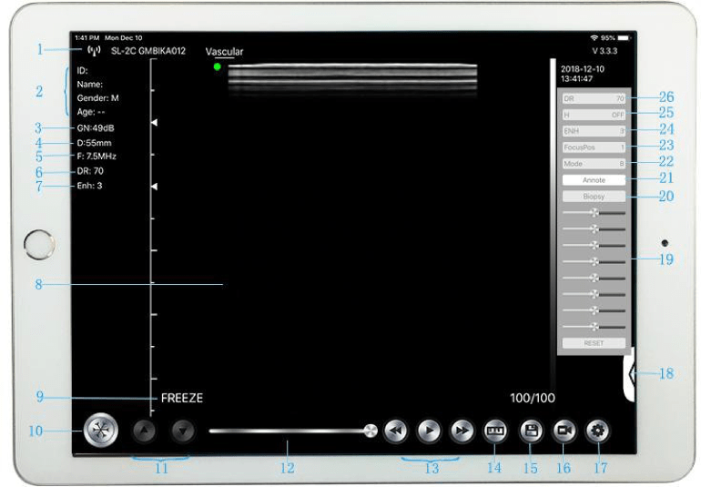 Wireless Ultrasound probes for veterinary scanning