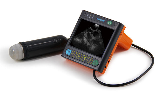 Generic Ultrasound Machine for Pregnancy,Wireless Portable Ultrasound  Scanner with 3.5 MHz Mechanical Probe, Smart Handheld Rechargeable  Ultrasound